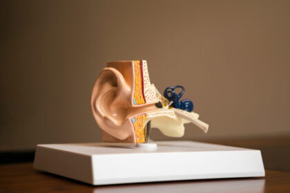 Síndrome de Susac: una enfermedad rara que provoca pérdida auditiva